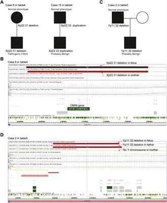 Retrospective analysis of the sex chromosomal copy number variations in 186 fetuses using single nucleotide polymorphism arrays